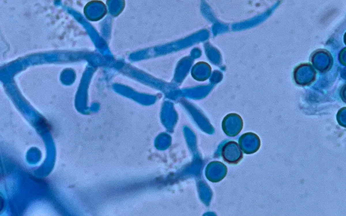 Rizobacterii și Trichoderma